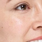 Чистење на акни