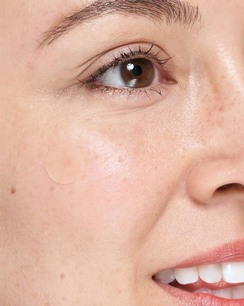 Чистење на акни